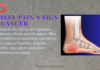 Is Heel Pain a Sign of Cancer: Heel Pain During Cancer Is Heel Pain a Sign of Cancer