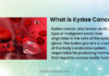What is Kydae Cancer: All You Need to Know Kydae Cancer