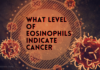 What Level Of Eosinophils Indicate Cancer What Level Of Eosinophils Indicate Cancer