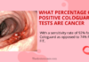 What Percentage of Positive Cologuard Tests Are Cancer What Percentage of Positive Cologuard Tests Are Cancer