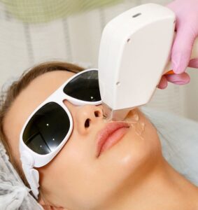 Does Laser Hair Removal Cause Cancer