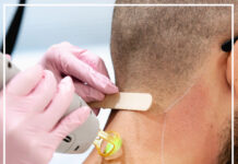 Does Laser Hair Removal Cause Cancer: Laser Hair Removal Risks Does Laser Hair Removal Cause Cancer