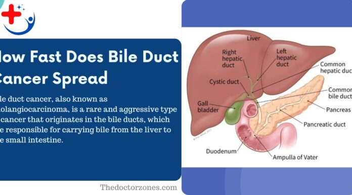 How Fast Does Bile Duct Cancer Spread: How Aggressive Is Bile Duct Cancer? How Fast Does Bile Duct Cancer Spread