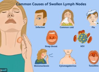 Can Vaping Cause Lymph Node Cancer: E-cigarettes and cancer Can Vaping Cause Lymph Node Cancer