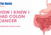 How I Knew I Had Colon Cancer: Symptoms of colon cancer How I Knew I Had Colon Cancer