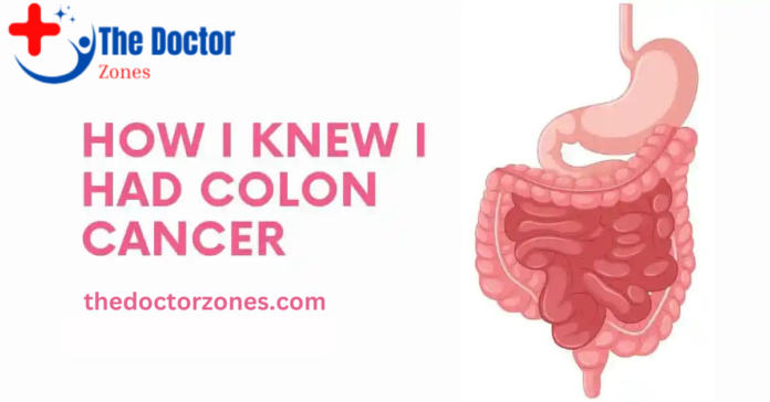 How I Knew I Had Colon Cancer