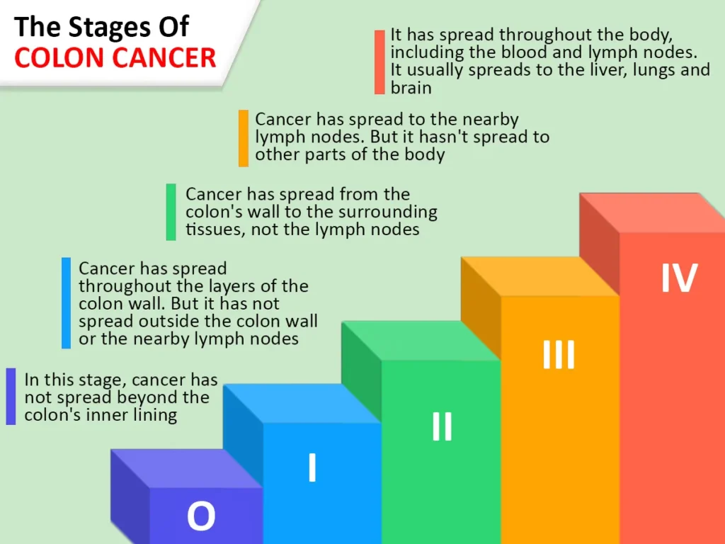 Stage 4 Colon Cancer Survival Rate