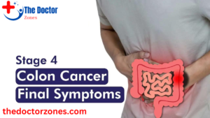 Stage 4 Colon Cancer