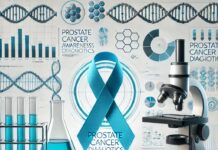 Decipher Test for Prostate Cancer: Decipher Test Prostate Cancer Decipher Test Prostate Cancer