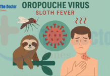 Oropouche Virus Sloth Fever: What You Must Know About This Emerging Threat in 2025 Oropouche Virus Sloth Fever