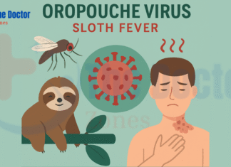 Oropouche Virus Sloth Fever: What You Must Know About This Emerging Threat in 2025 Oropouche Virus Sloth Fever