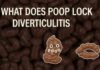 What Does Poop Look Like With Diverticulitis What Does Poop Look Like With Diverticulitis