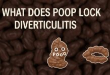 What Does Poop Look Like With Diverticulitis What Does Poop Look Like With Diverticulitis